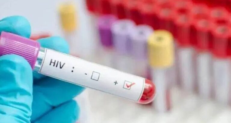 400-erkege-bilerek-hiv-virusunu-bulastirdi-ulkede-herkes-panige-kapildi-sRHVgL1q.jpg