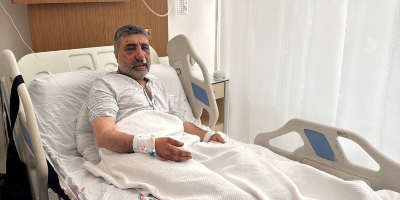 ingiliz boksorun darp ettigi taksicinin davasi goruldu geceleri bagirarak uyaniyorum lOj2j8Gh.jpg